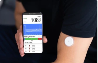 What is CGM? (Continuous Glucose Monitoring) - Sugar.Fit