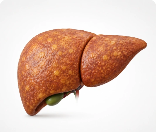 Fatty Liver Analysis